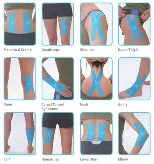 Kinesiology Tape Adhesive for Muscle Pain Relief